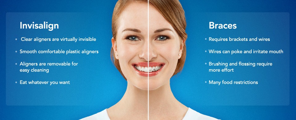 compare-the-braces