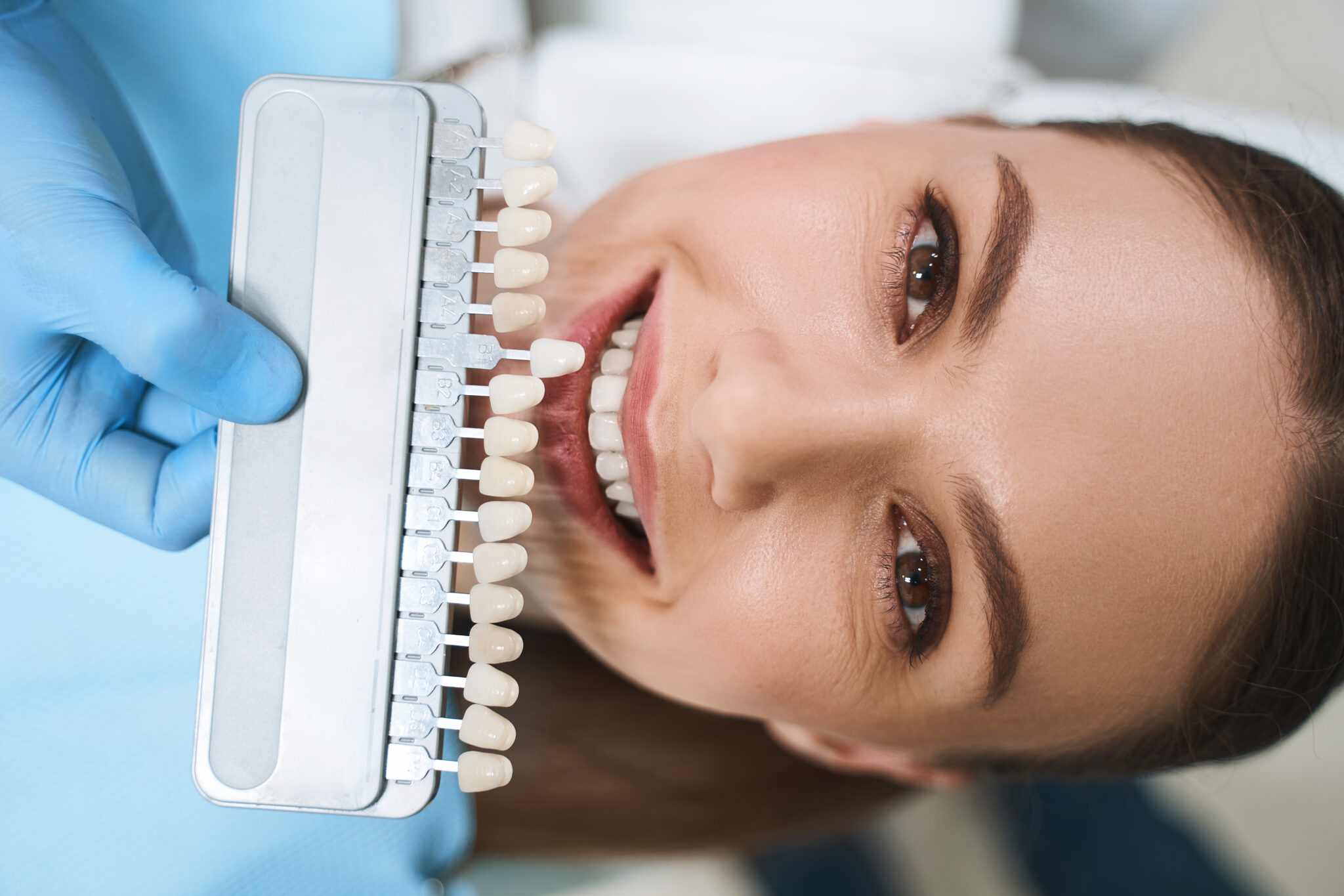 DO VENEERS DAMAGE YOUR TEETH? Prime Orthodontics